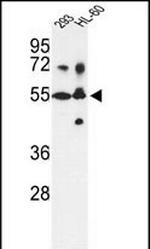 CYP21A2 Antibody in Western Blot (WB)