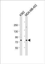 ALOX15 Antibody in Western Blot (WB)