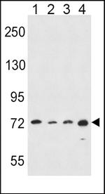 ALOX15 Antibody in Western Blot (WB)