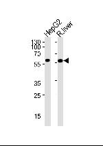 GCK Antibody in Western Blot (WB)