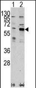 PAK3 Antibody in Western Blot (WB)