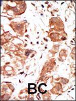 PIM1 Antibody in Immunohistochemistry (Paraffin) (IHC (P))