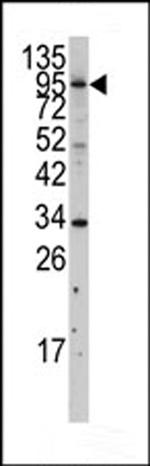 MLCK Antibody in Western Blot (WB)