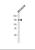 MYLK Antibody in Western Blot (WB)