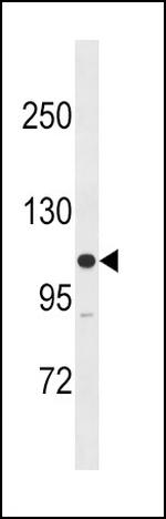 MYLK Antibody in Western Blot (WB)