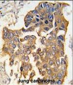 Caspase 9 Antibody in Immunohistochemistry (Paraffin) (IHC (P))