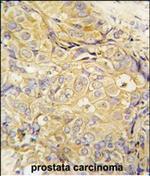 FGF10 Antibody in Immunohistochemistry (Paraffin) (IHC (P))