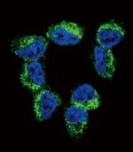 BDNF Antibody in Immunocytochemistry (ICC/IF)