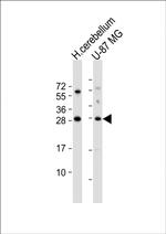 BDNF Antibody in Western Blot (WB)