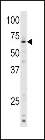 CYP1A1 Antibody in Western Blot (WB)