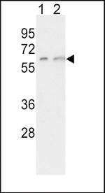 CYP7A1 Antibody in Western Blot (WB)