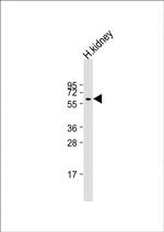 PI4K2A Antibody in Western Blot (WB)