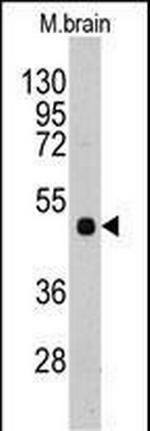 PI4K2A Antibody in Western Blot (WB)