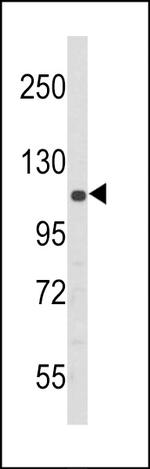 PERK Antibody in Western Blot (WB)