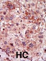 GAK Antibody in Immunohistochemistry (Paraffin) (IHC (P))