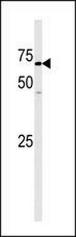 GAK Antibody in Western Blot (WB)