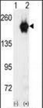 GAK Antibody in Western Blot (WB)