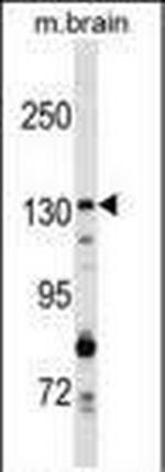 GAK Antibody in Western Blot (WB)