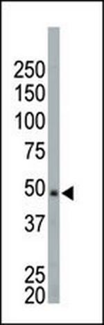 NEK2 Antibody in Western Blot (WB)