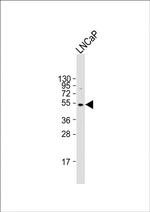 ULK3 Antibody in Western Blot (WB)