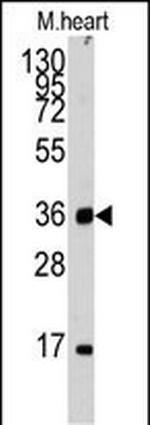 ULK3 Antibody in Western Blot (WB)