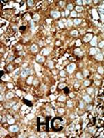 PFKFB3 Antibody in Immunohistochemistry (Paraffin) (IHC (P))