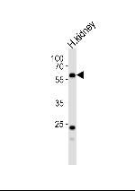 PFKFB3 Antibody in Western Blot (WB)