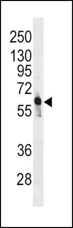 PFKFB3 Antibody in Western Blot (WB)