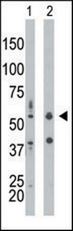 PKR Antibody in Western Blot (WB)