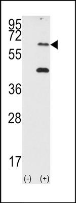 PKR Antibody in Western Blot (WB)