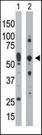 PKR Antibody in Western Blot (WB)