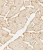 PFKFB4 Antibody in Immunohistochemistry (Paraffin) (IHC (P))