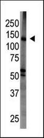 MAGI1 Antibody in Western Blot (WB)