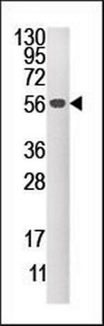 MKP2 Antibody in Western Blot (WB)