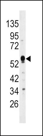 MKP2 Antibody in Western Blot (WB)