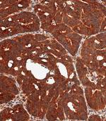 MKP3 Antibody in Immunohistochemistry (Paraffin) (IHC (P))