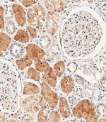 MKP3 Antibody in Immunohistochemistry (Paraffin) (IHC (P))