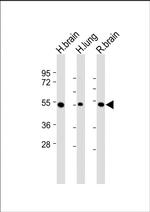 MKP3 Antibody in Western Blot (WB)