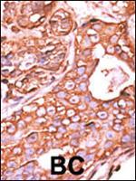 PPM1F Antibody in Immunohistochemistry (Paraffin) (IHC (P))