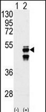 PPM1F Antibody in Western Blot (WB)