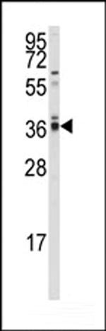 PP2A alpha Antibody in Western Blot (WB)