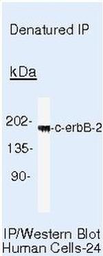 ErbB2 (HER-2) Antibody in Immunoprecipitation (IP)