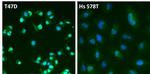 Estrogen Receptor alpha Antibody