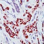 Estrogen Receptor alpha Antibody in Immunohistochemistry (Paraffin) (IHC (P))