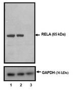 NFkB p65 Antibody