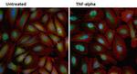 NFkB p65 Antibody