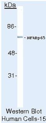 NFkB p65 Antibody in Western Blot (WB)