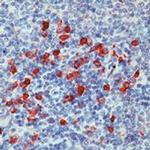 Kappa Light Chain Antibody in Immunohistochemistry (Paraffin) (IHC (P))