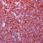 CD20 Antibody in Immunohistochemistry (Paraffin) (IHC (P))