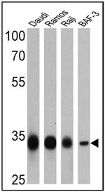 CD20 Antibody in Western Blot (WB)